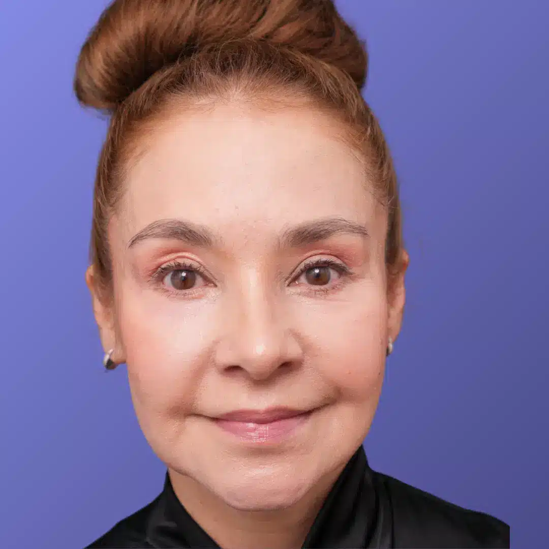 Peeling profundo en Bogotá