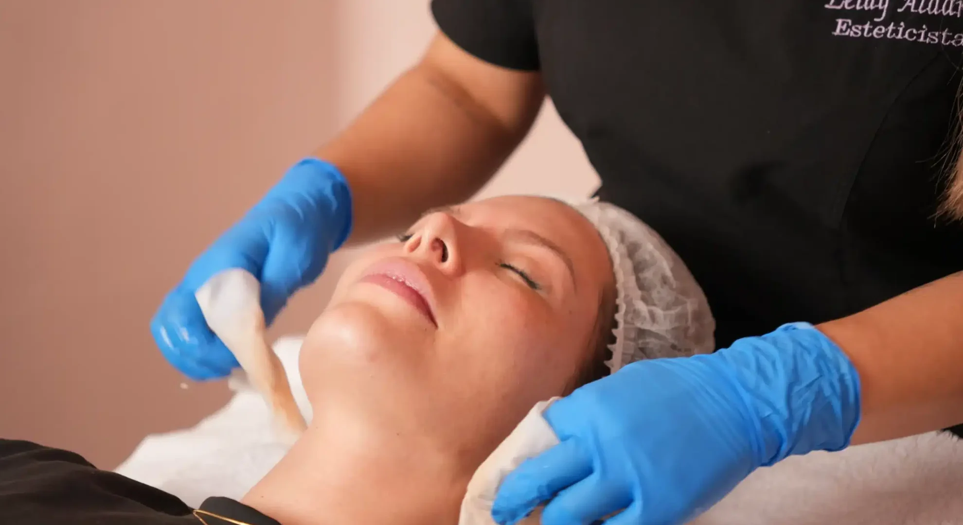 Peeling profundo en Bogotá